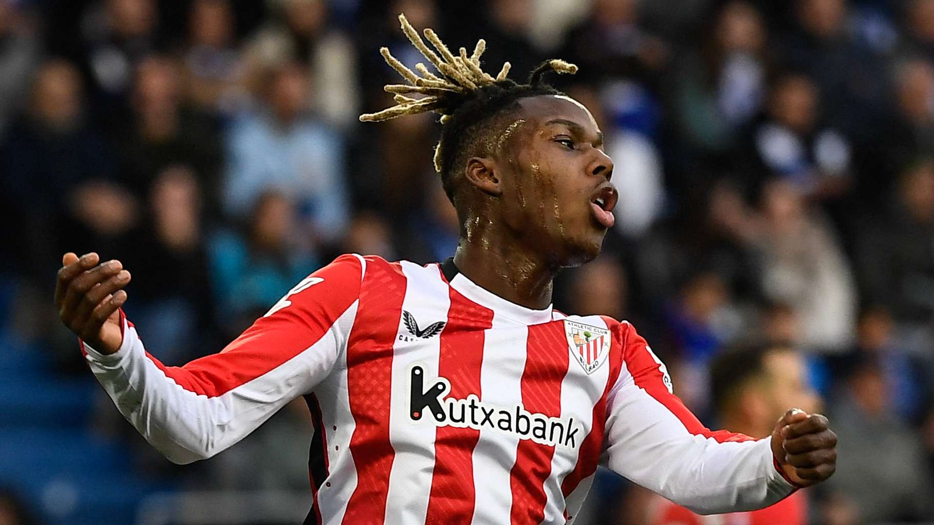 意媒：和德弗赖相撞后遭误伤，巴斯托尼右眼眉骨被缝了两针.